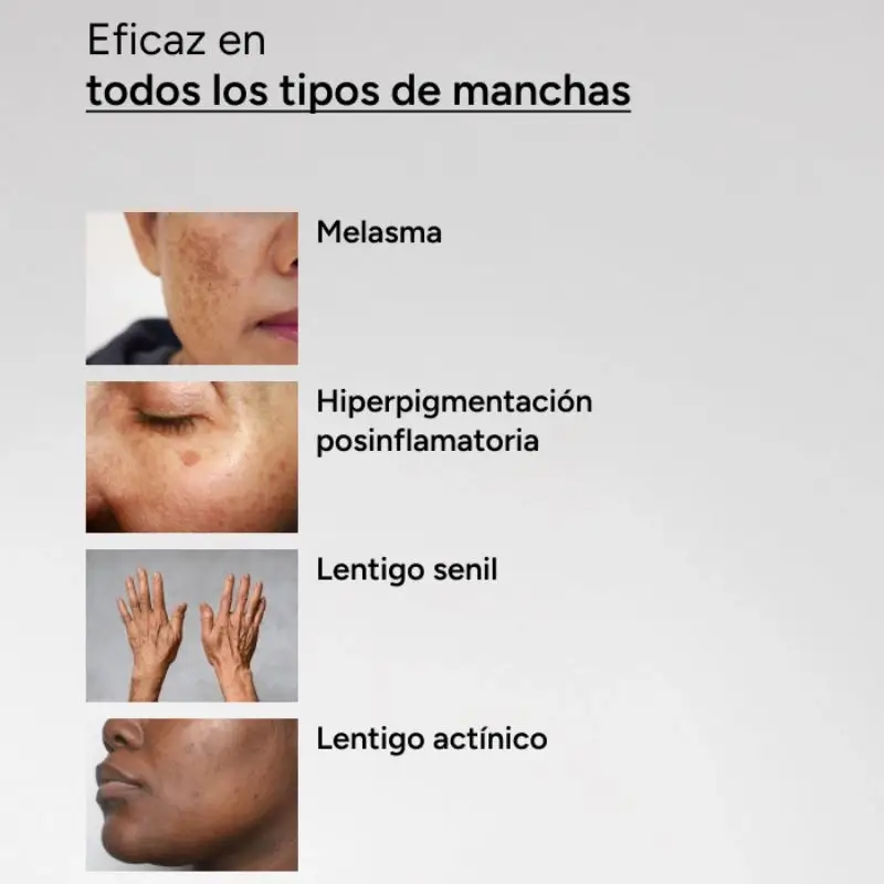 Acm Laboratoires Depiwhite Sérum Concentrado Intensivo Antimanchas , 30 ml - Image 12