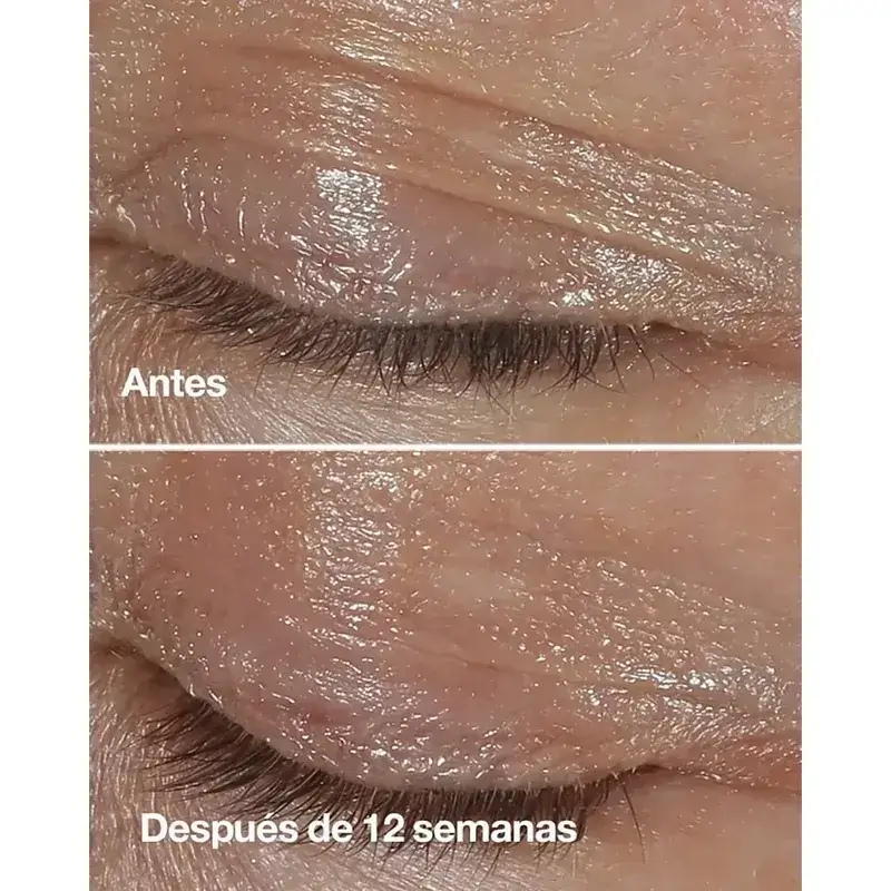 Clinique Smart Clinical Repair Crema de Contorno de Ojos de Corrección Antiarrugas, 2x15 ml - Image 3